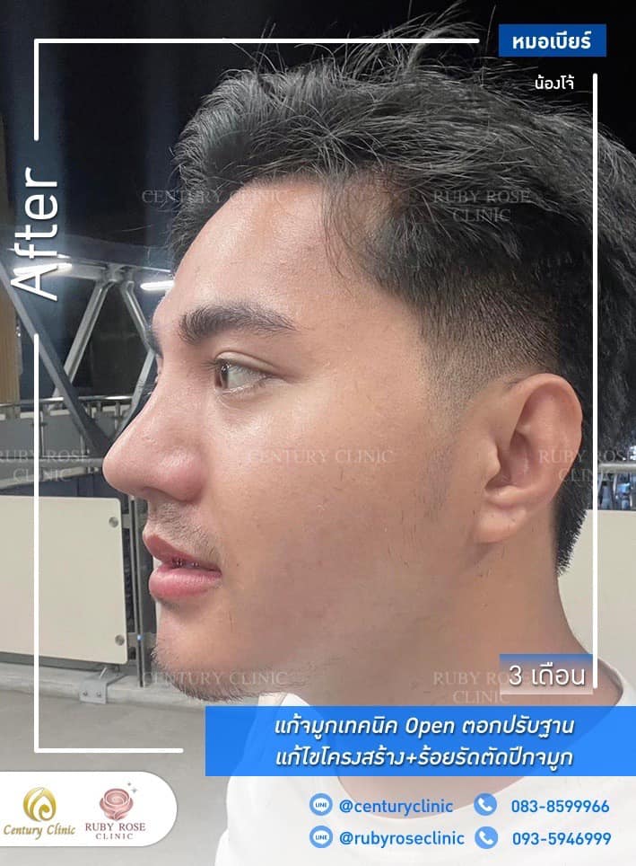 Century Clinic Thailand