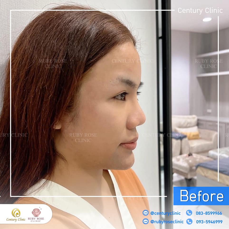 Century Clinic Thailand