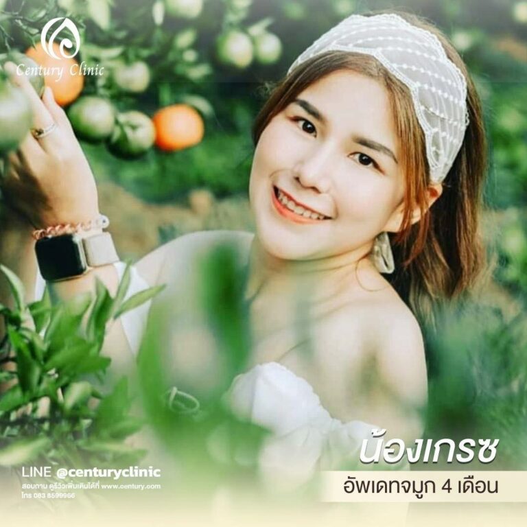 Century-รีวิว-แก้จมูก 1#571