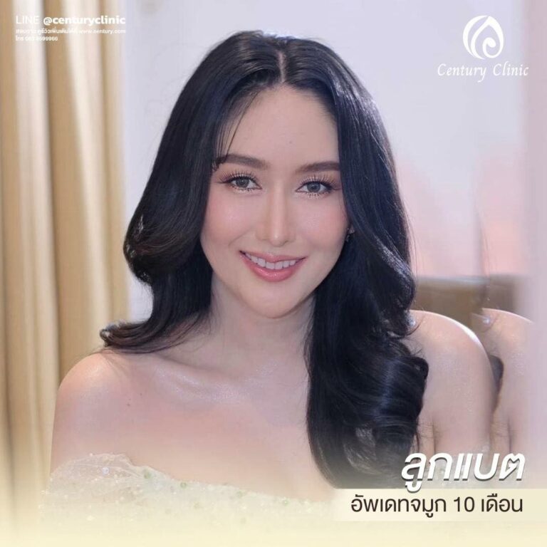 Century-รีวิว-แก้จมูก 1#572