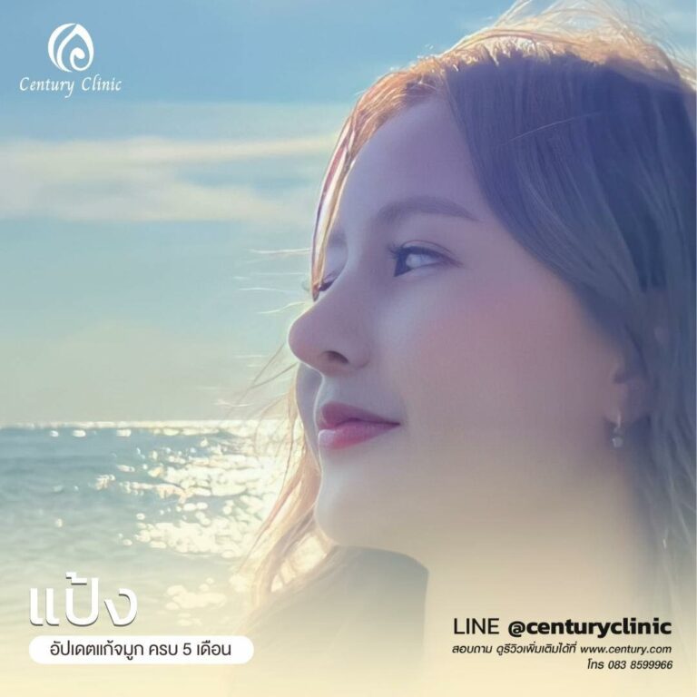 Century-รีวิว-แก้จมูก #561