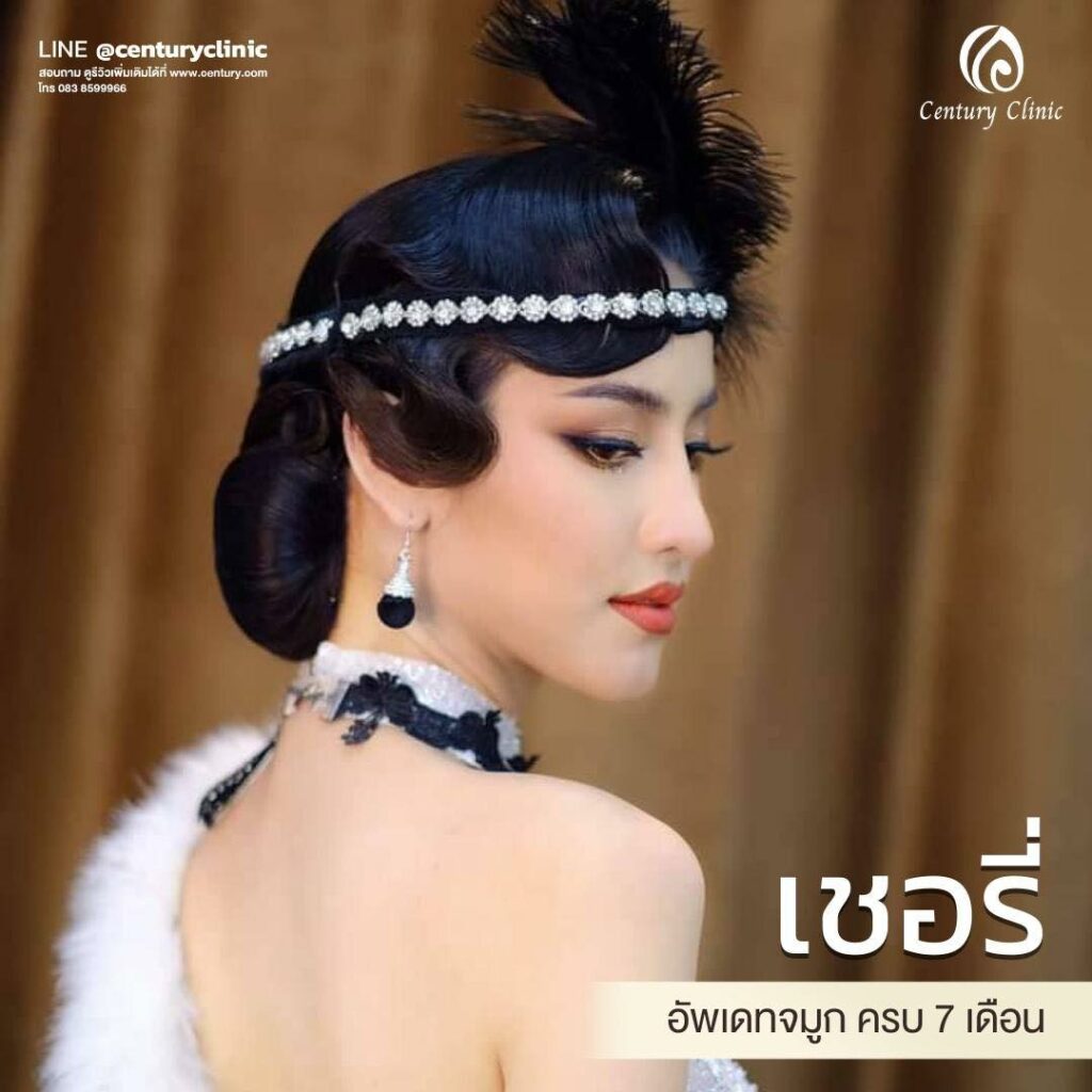 รีวิว เสริมจมูก #582 , Century Clinic Thailand Century-รีวิว-เสริมจมูก 1#582