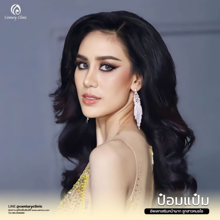 Century-รีวิว-เสริมจมูก #618