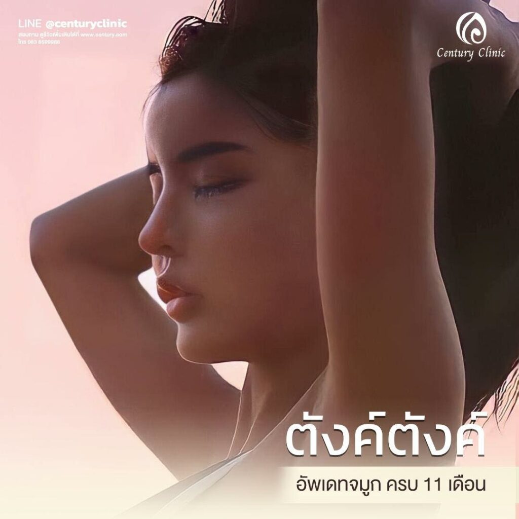 Century-รีวิว-แก้จมูก 1#584