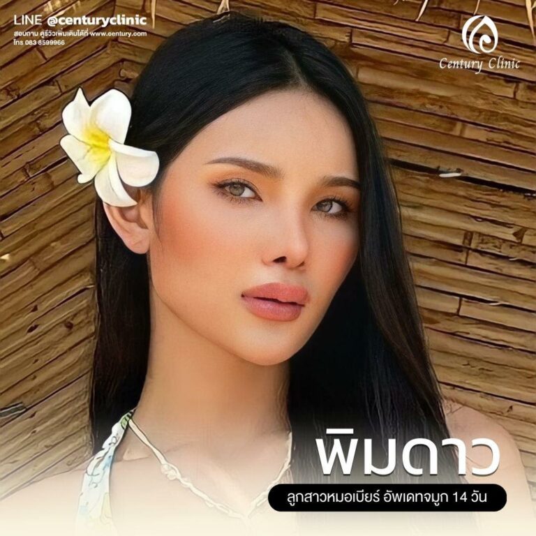 Century-รีวิว-เสริมจมูก #636