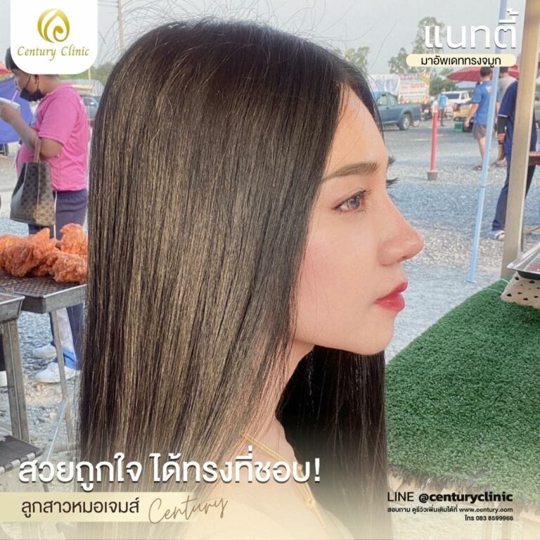 Century-รีวิว-เสริมจมูก #641