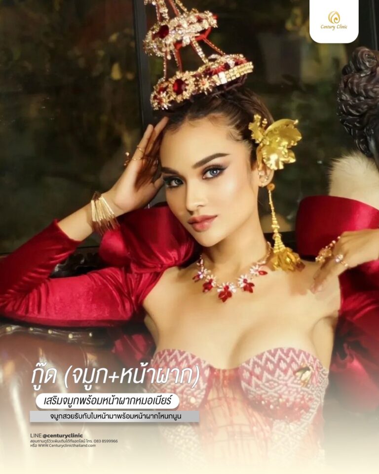 Century-รีวิว-เสริมจมูก-หน้าผาก#638