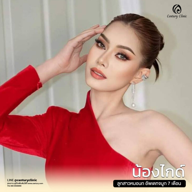 Century-รีวิว-แก้จมูก #623