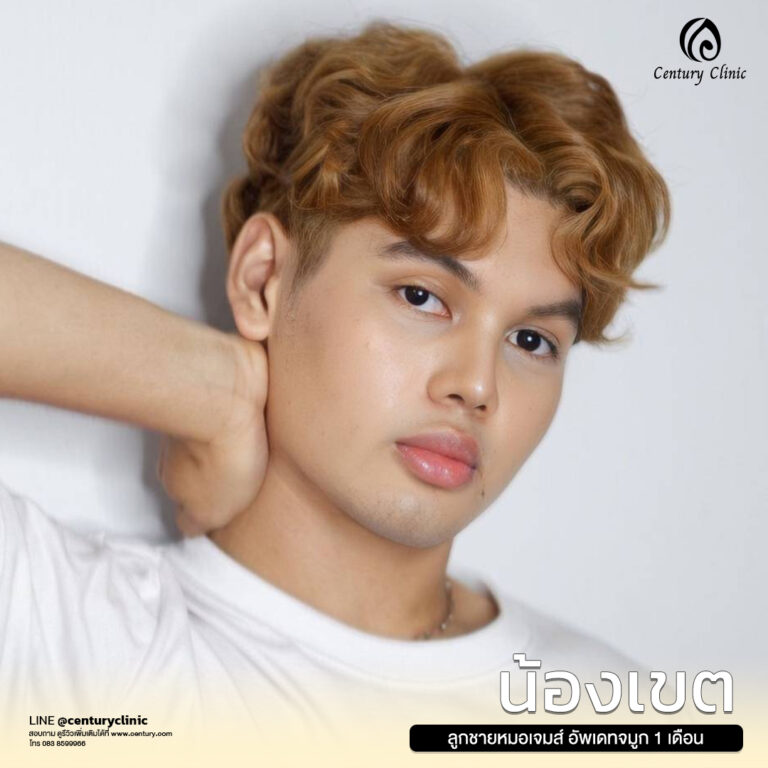 Century-รีวิว-แก้จมูก #633