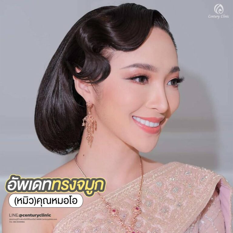 Century-รีวิว-เสริมจมูก #680
