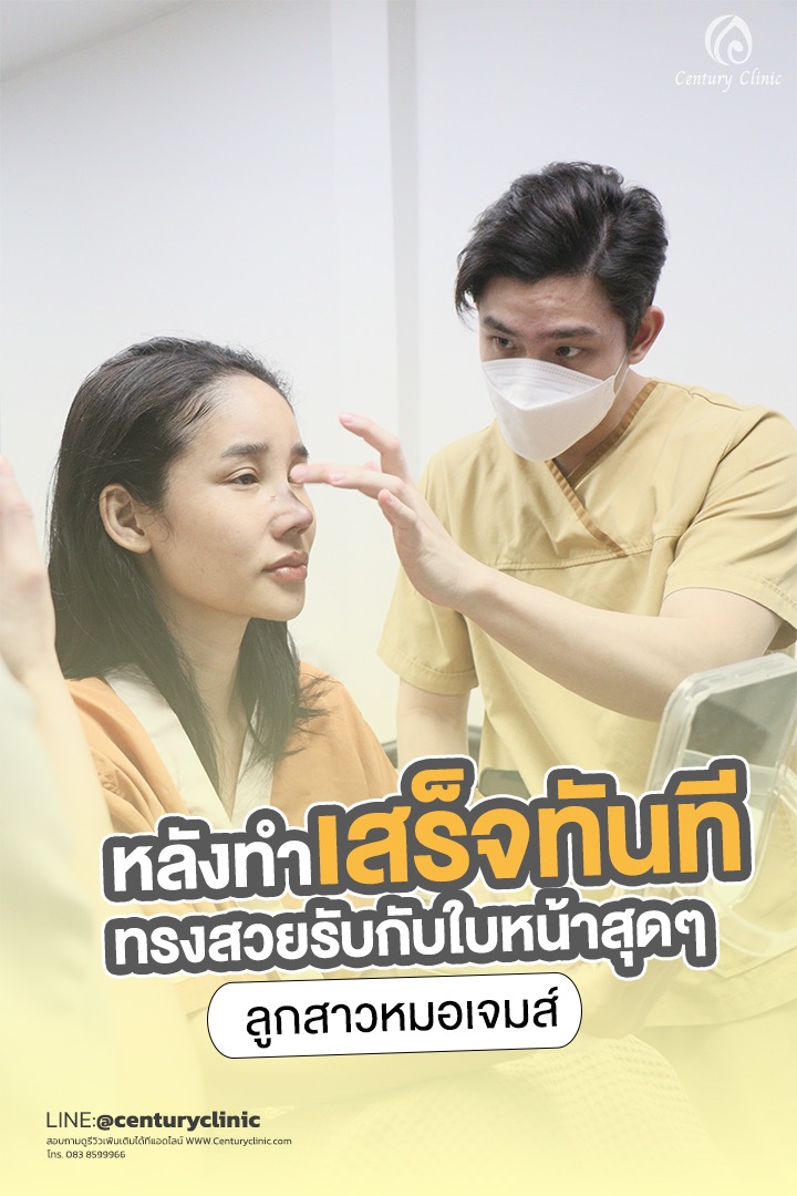 รีวิว แก้จมูก #667