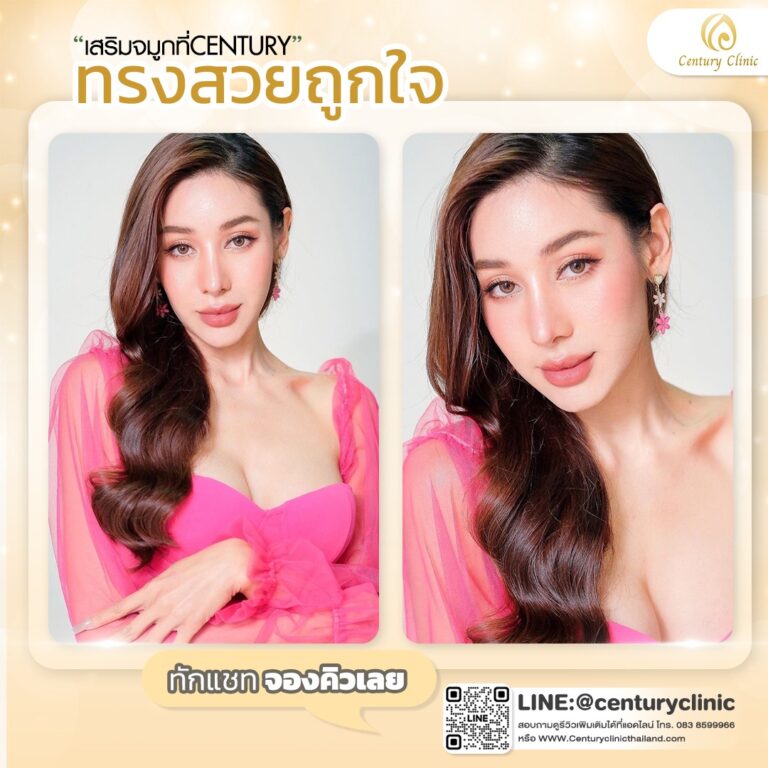 Century-รีวิว-เสริมจมูก #698