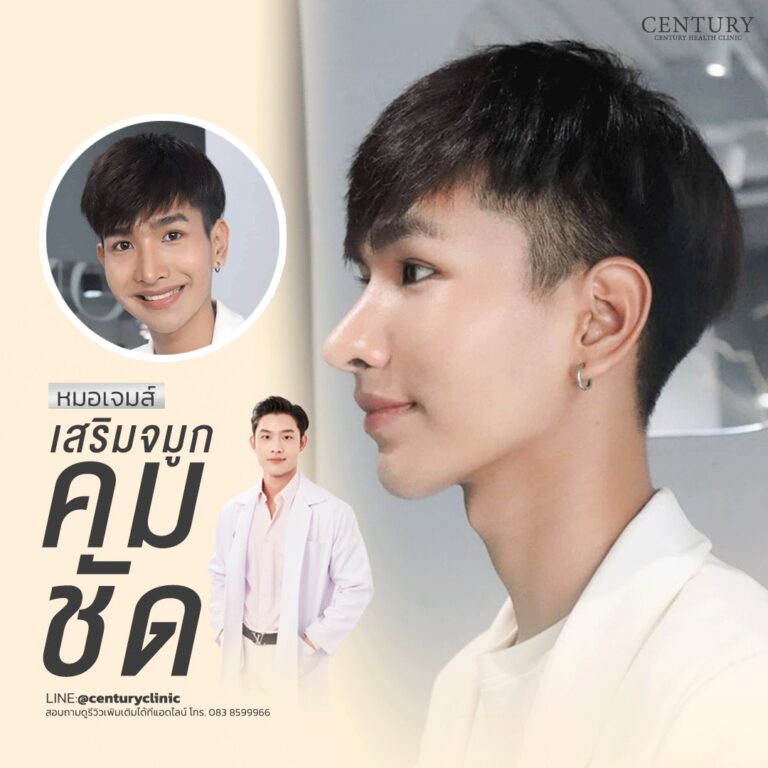 Century-รีวิว-เสริมจมูก #703