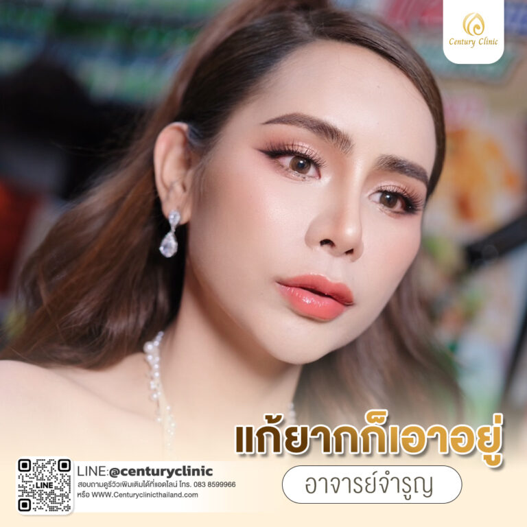 Century-รีวิว-แก้จมูก #711