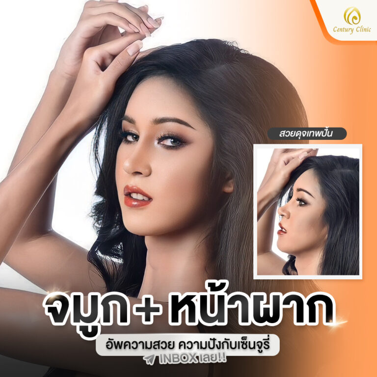 Century-รีวิว-เสริมจมูก #765