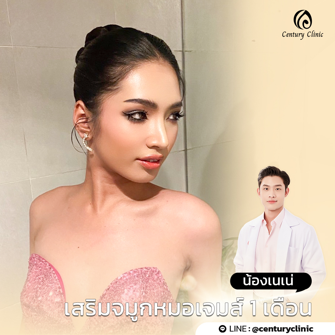 Century-รีวิว-แก้จมูก #741