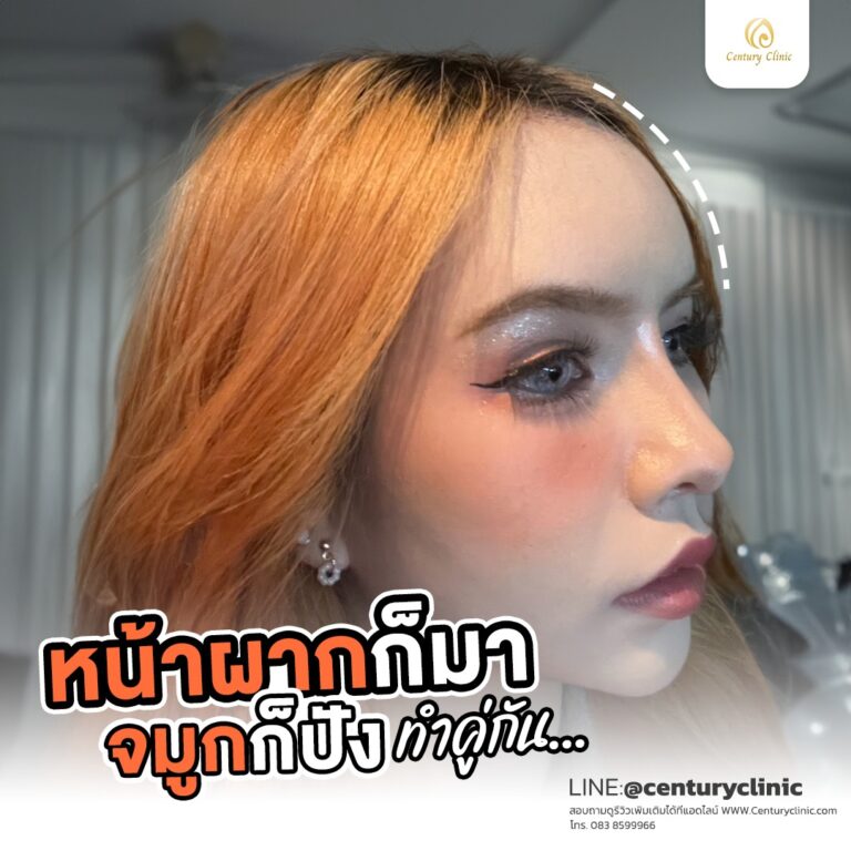 Century-รีวิว-แก้จมูก #743