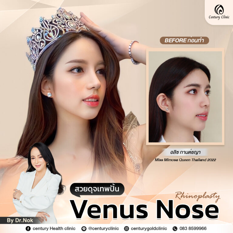Century-รีวิว-แก้จมูก #774