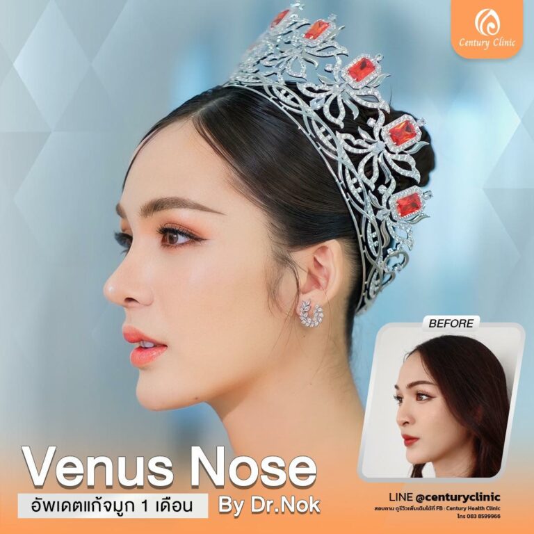 Century-รีวิว-แก้จมูก #781