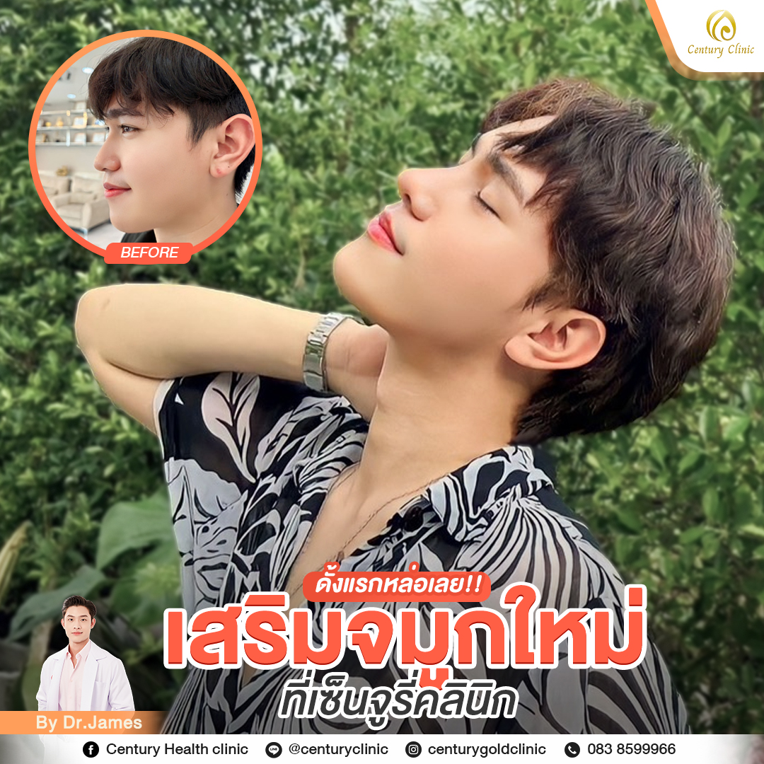 Century-รีวิว-เสริมจมูก #785