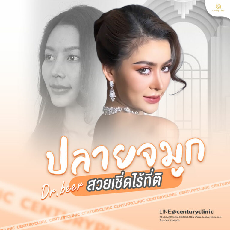 Century-รีวิว-แก้จมูก #783