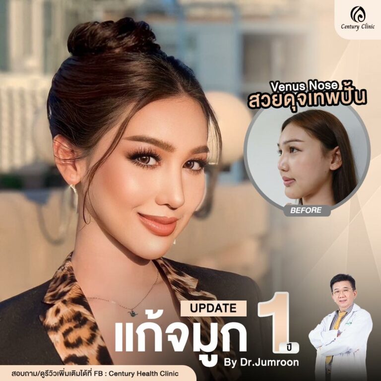 Century-รีวิว-แก้จมูก #797