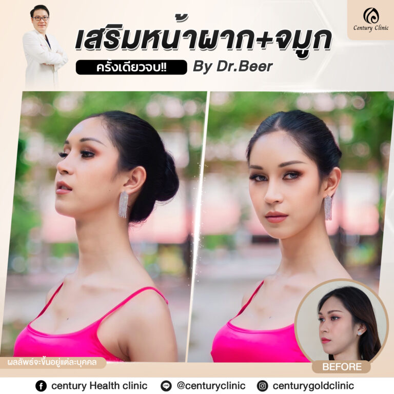 Century-รีวิว-แก้จมูก #812
