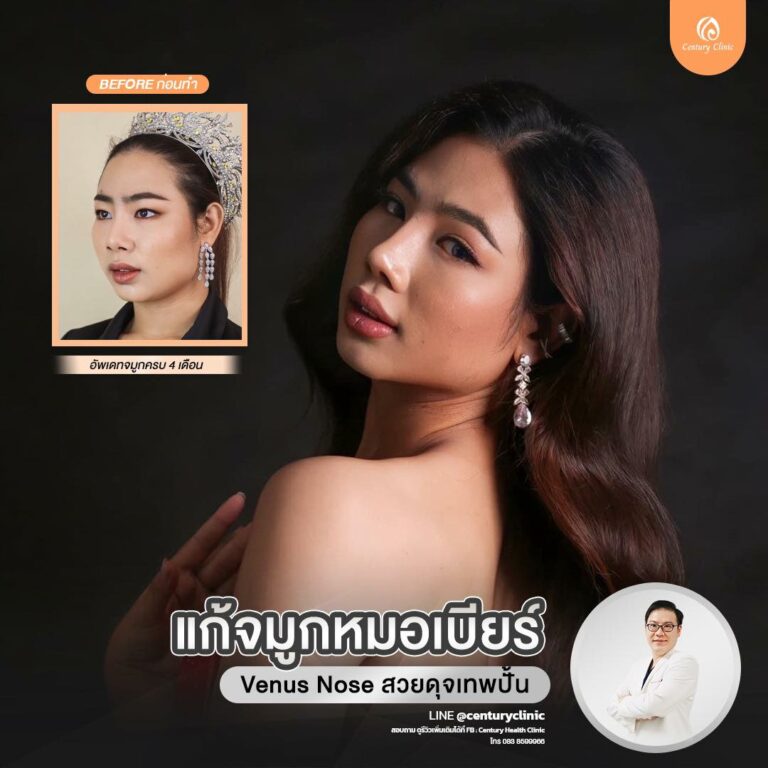 Century-รีวิว-แก้จมูก #820