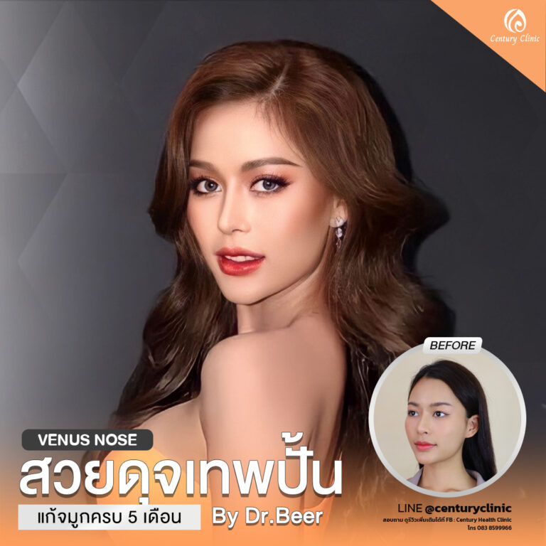 Century-รีวิว-แก้จมูก #828