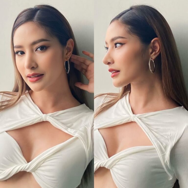 Century-รีวิว-เสริมจมูก #862