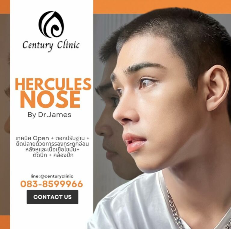 Century-รีวิว-เสริมจมูก #863