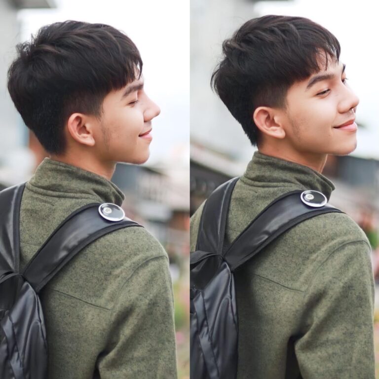รีวิว เสริมจมูก#850