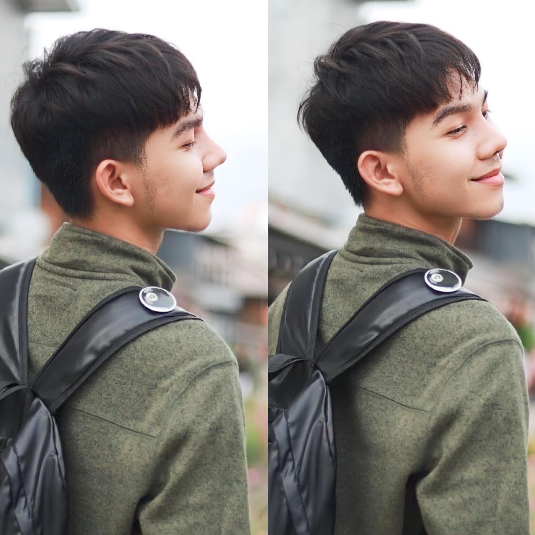 รีวิว เสริมจมูก#850