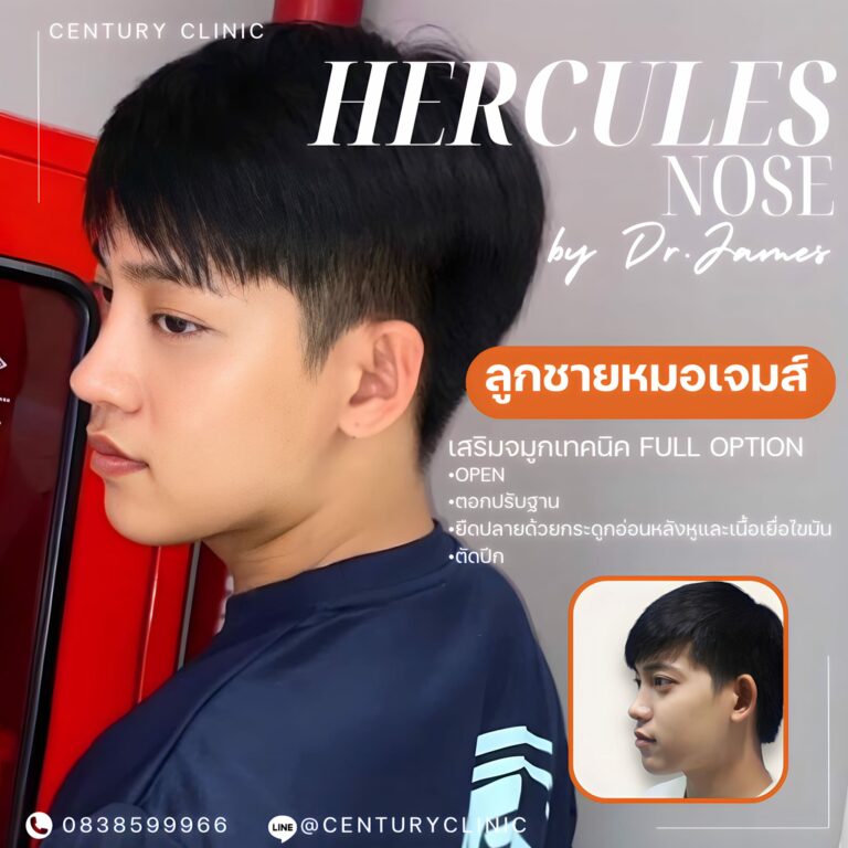 เสริม #902