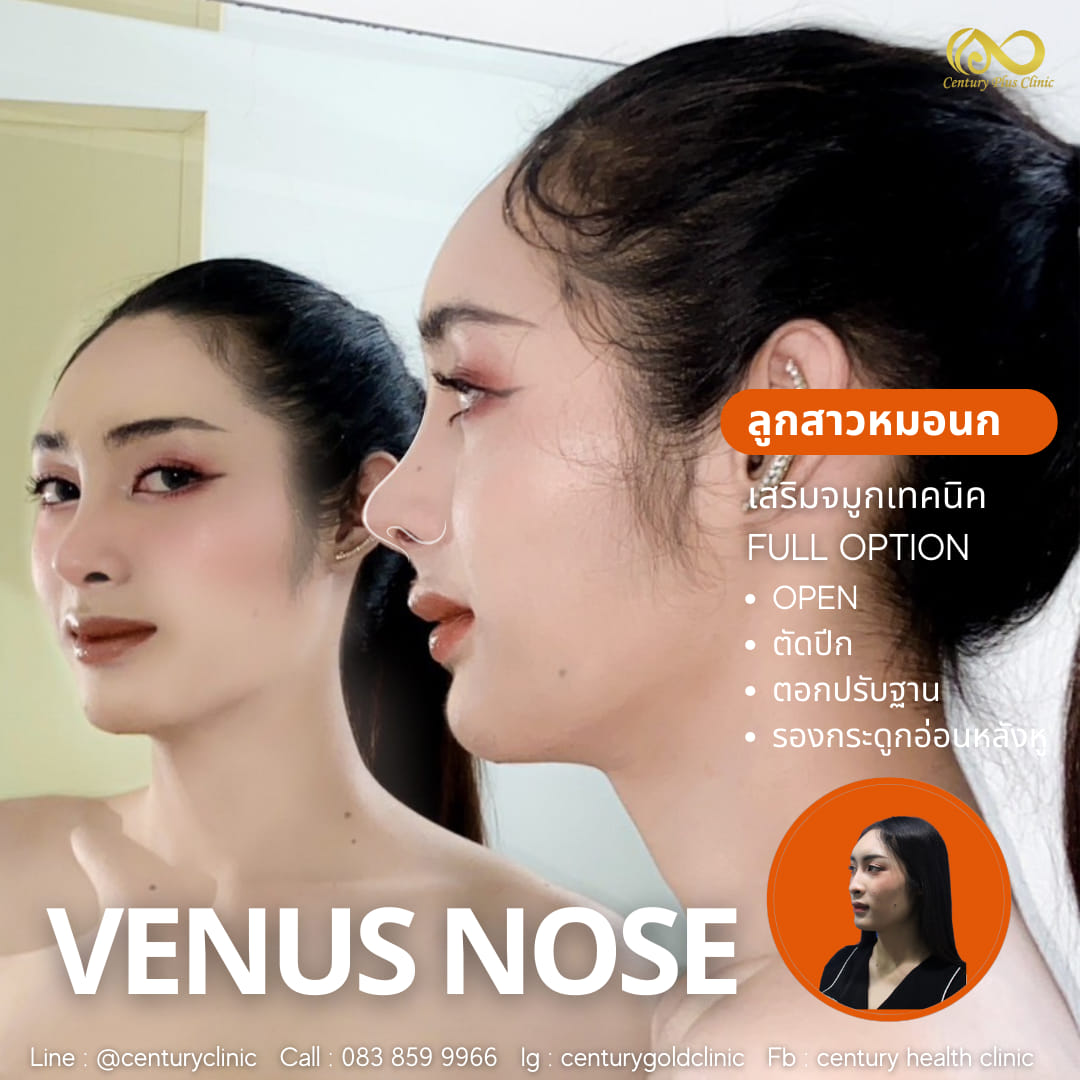 เสริมจมูก #913