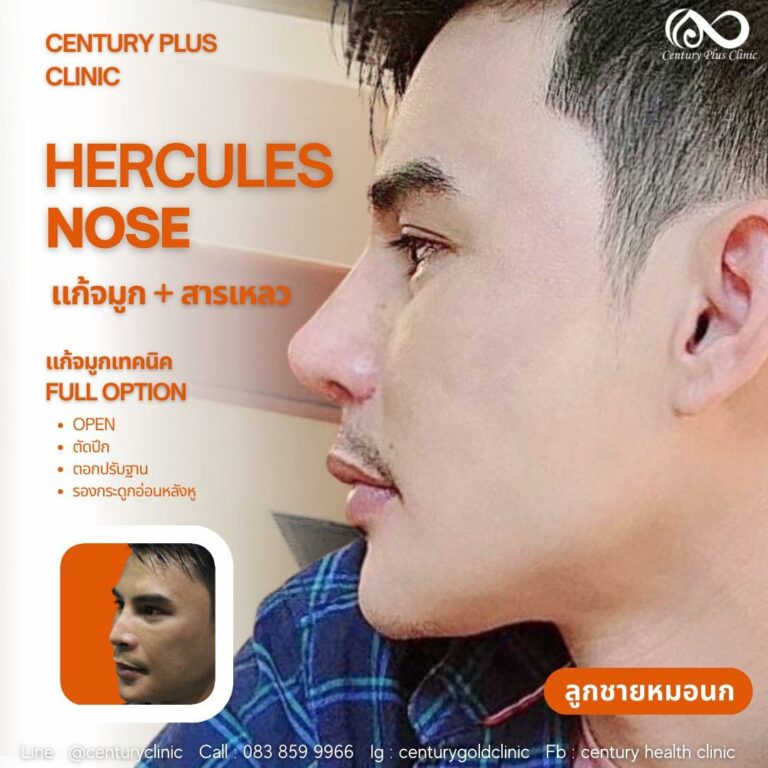 แก้จมูก #915