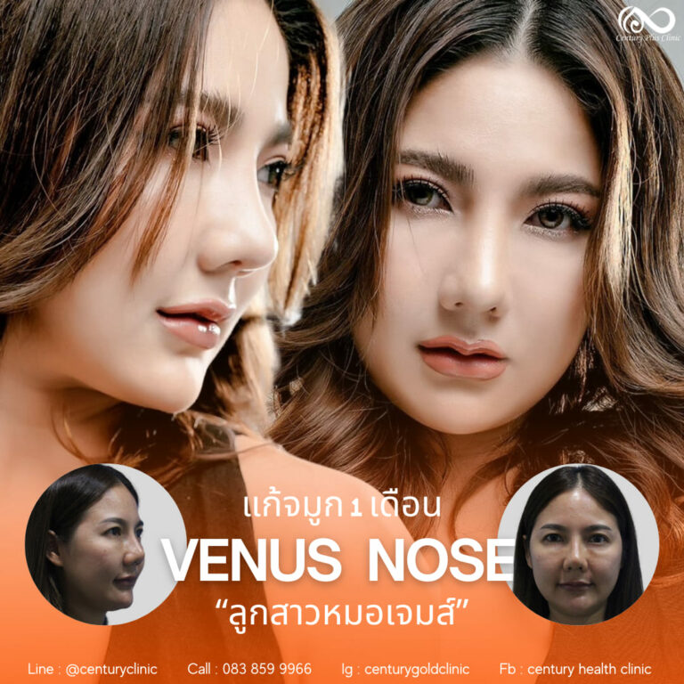 แก้จมูก #920