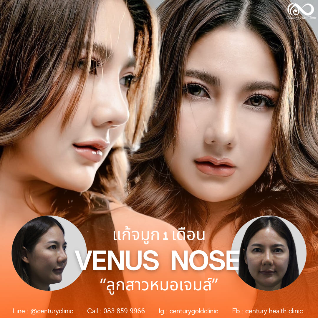 รีวิว แก้จมูก #920 , Century Clinic Thailand แก้จมูก #920