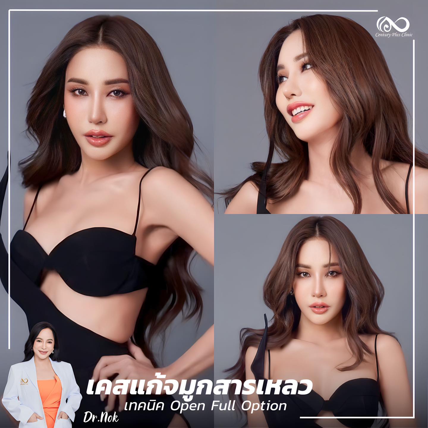 รีวิว แก้จมูก #1042 , Century Clinic Thailand แก้จมูก #1042