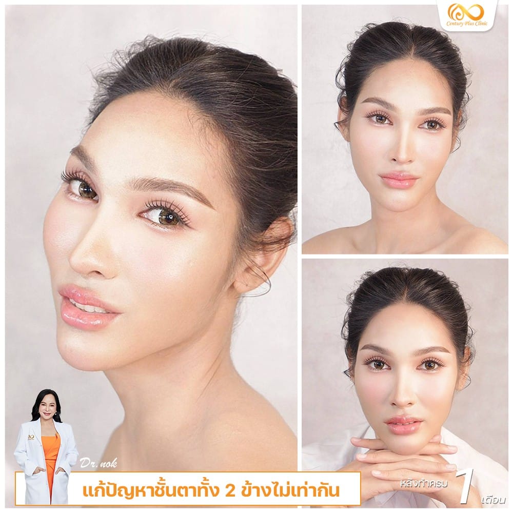 รีวิวตาสองชั้น #7