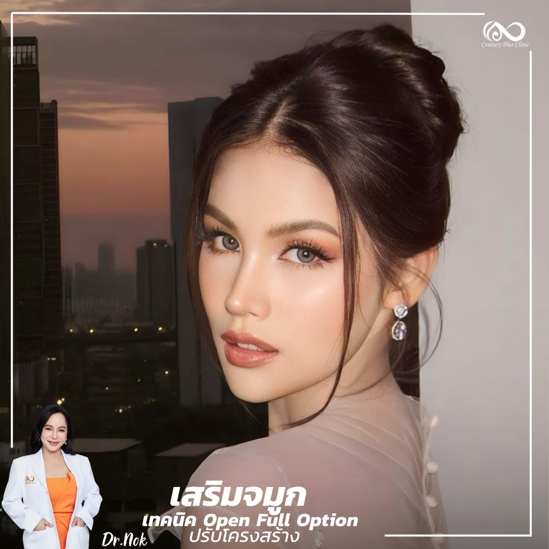 เสริมจมูก #1075