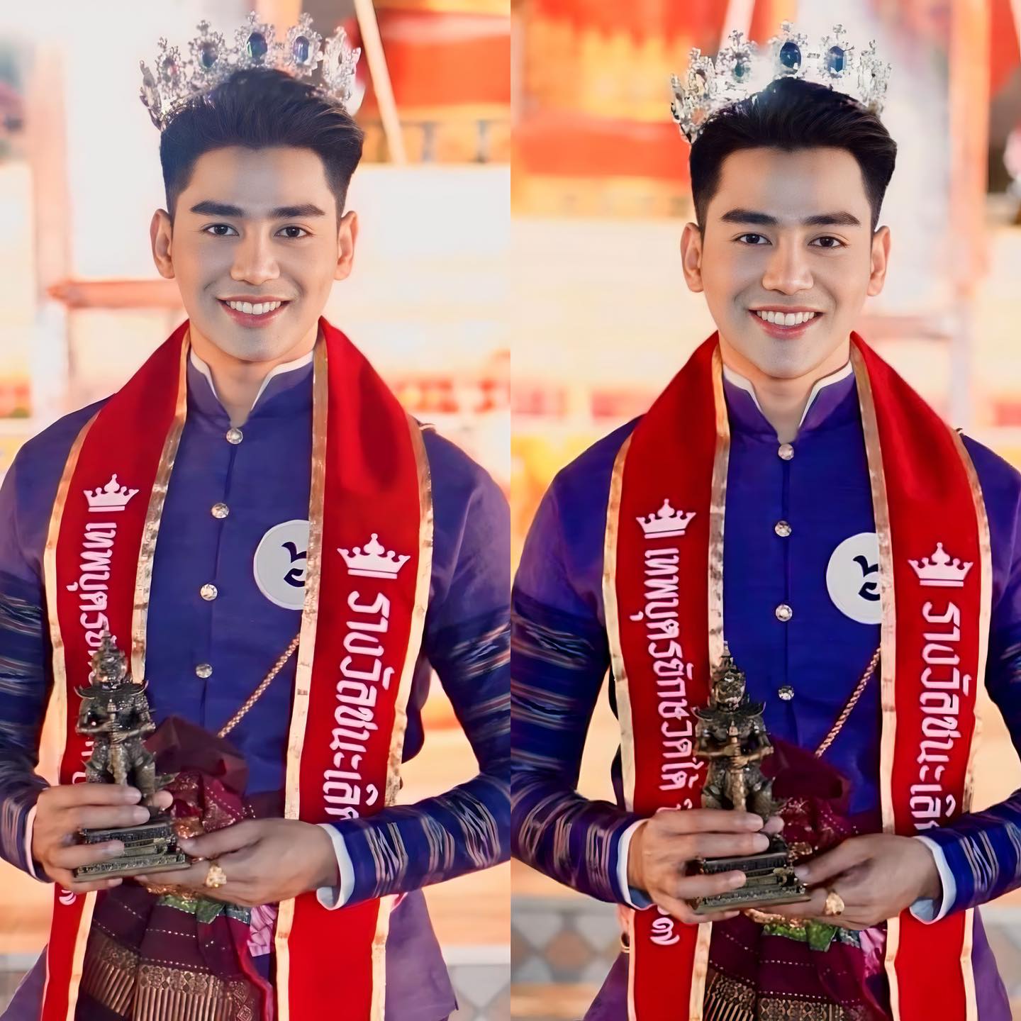 เสริมจมูก #1131