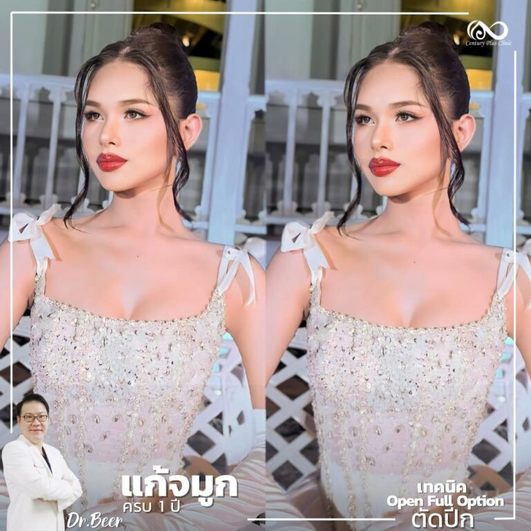 แก้จมูก #1064