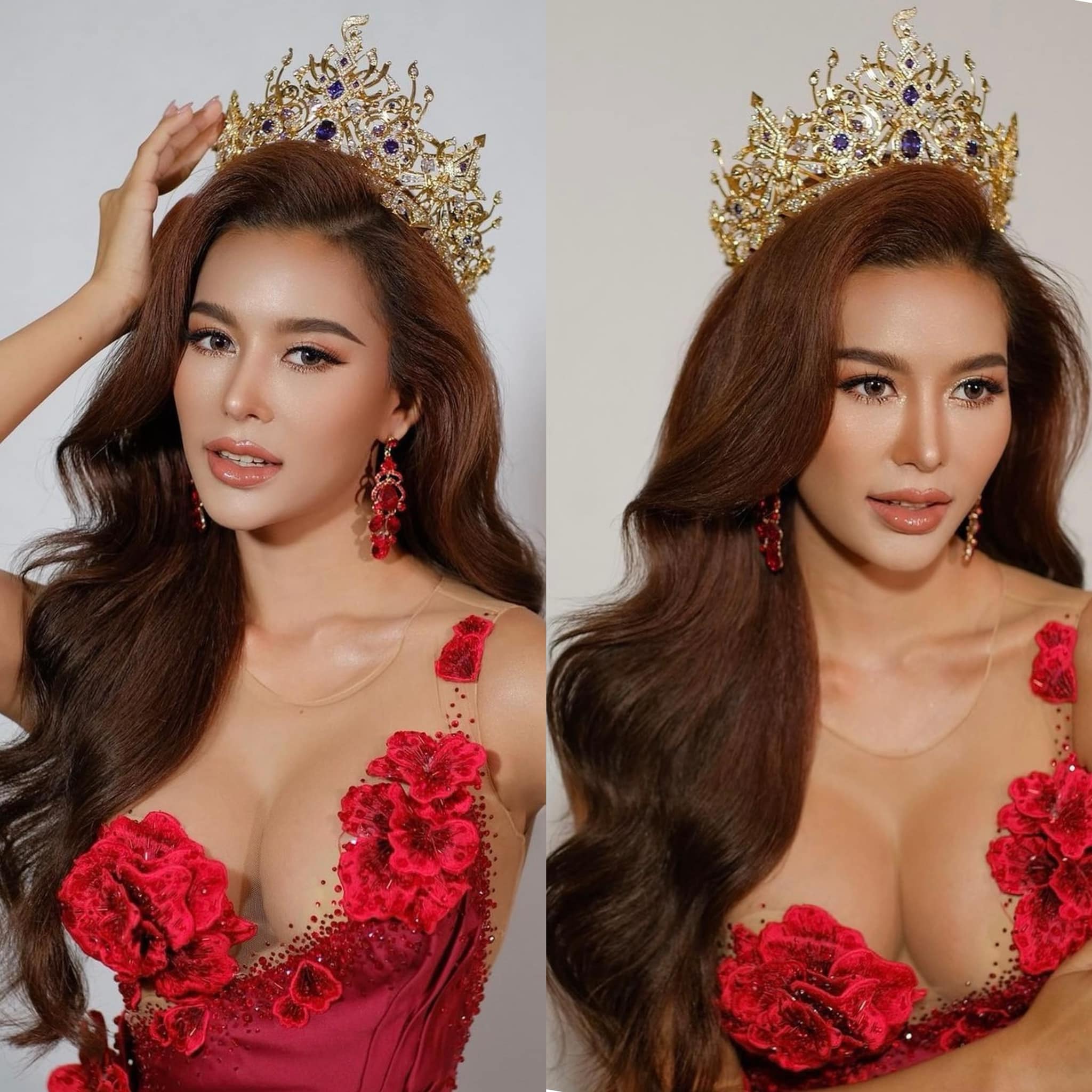 รีวิว แก้จมูก #1091 , Century Clinic Thailand แก้จมูก #1091