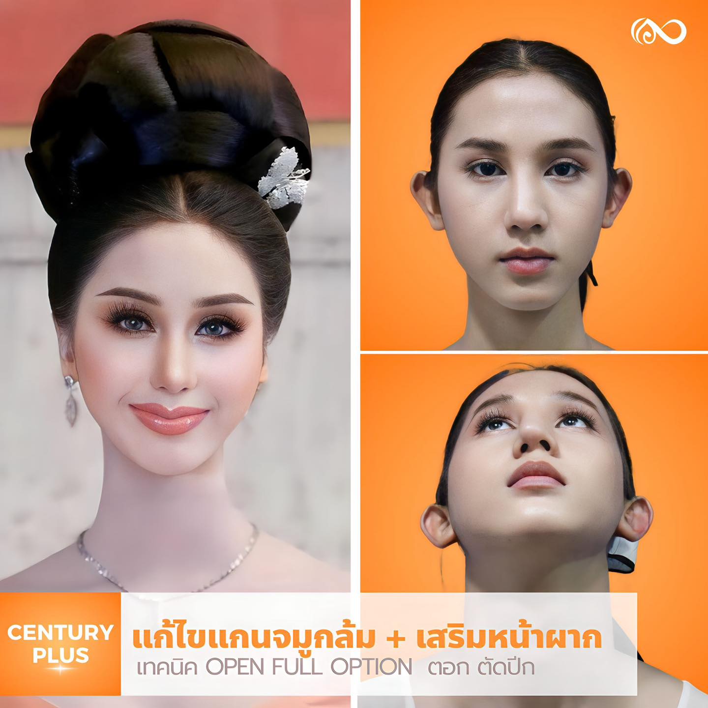 แก้จมูก #1107