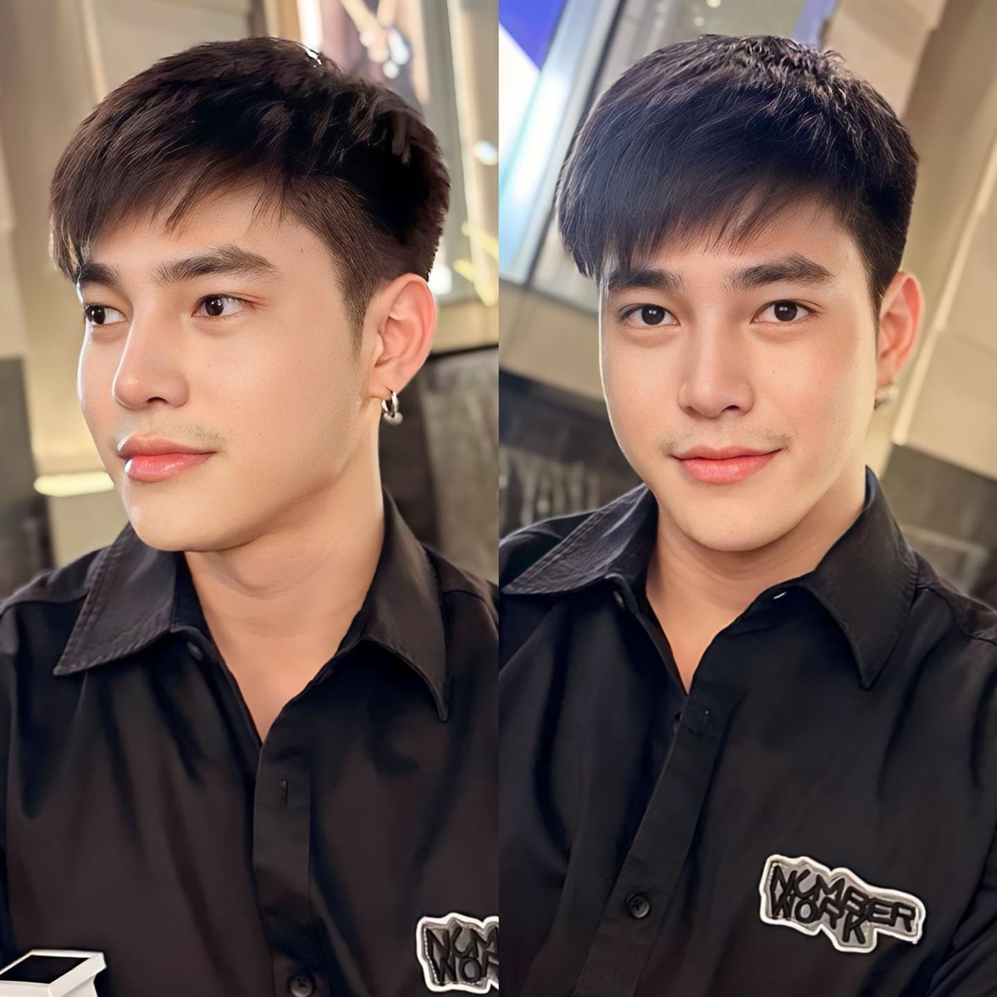 รีวิว แก้จมูก #1109 , Century Clinic Thailand แก้จมูก #1109