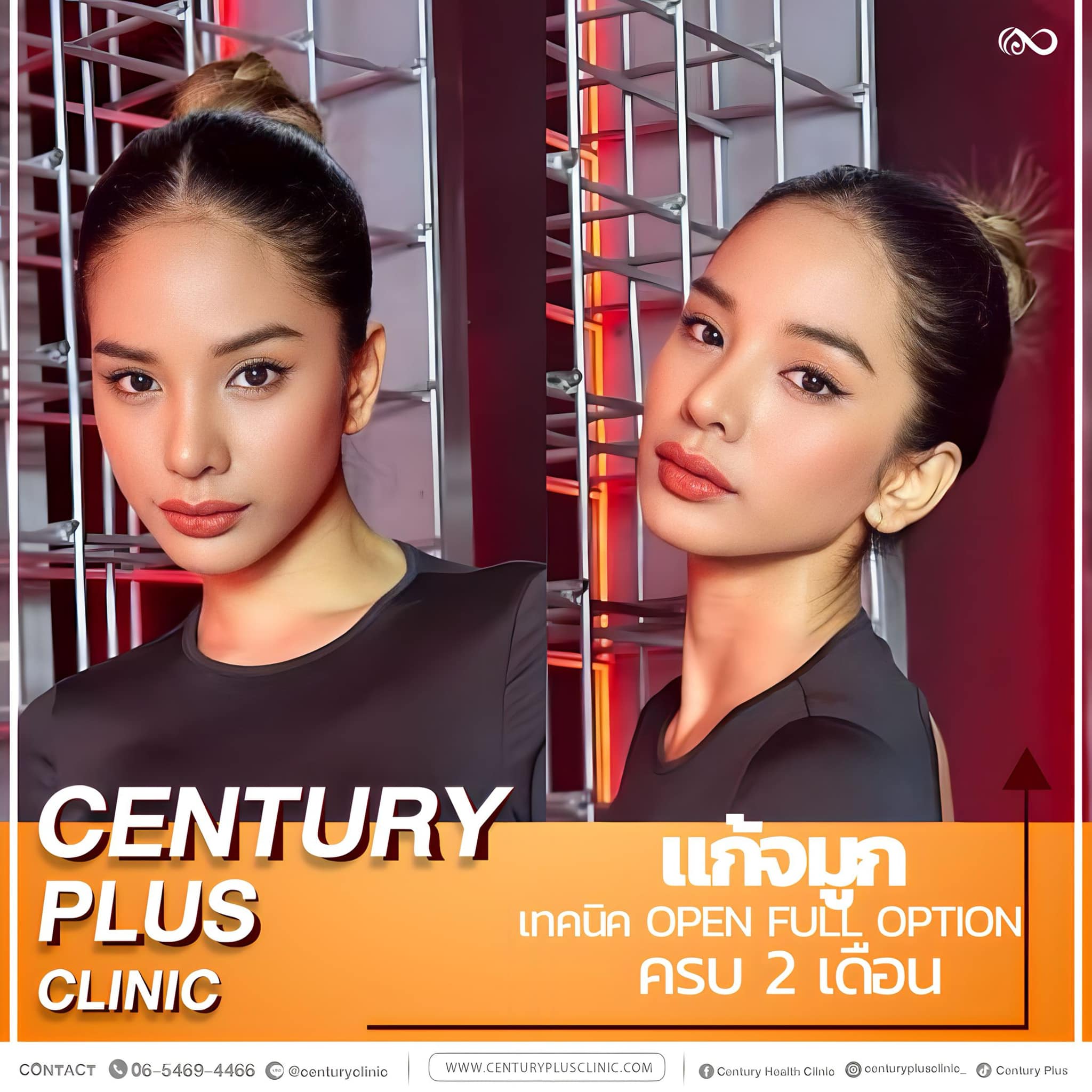 แก้จมูก #1117