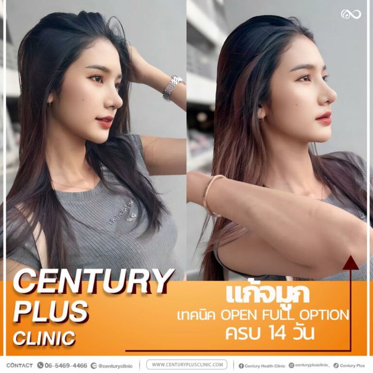แก้จมูก #1123