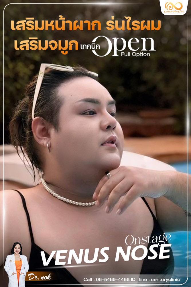 เสริมจมูก #1252
