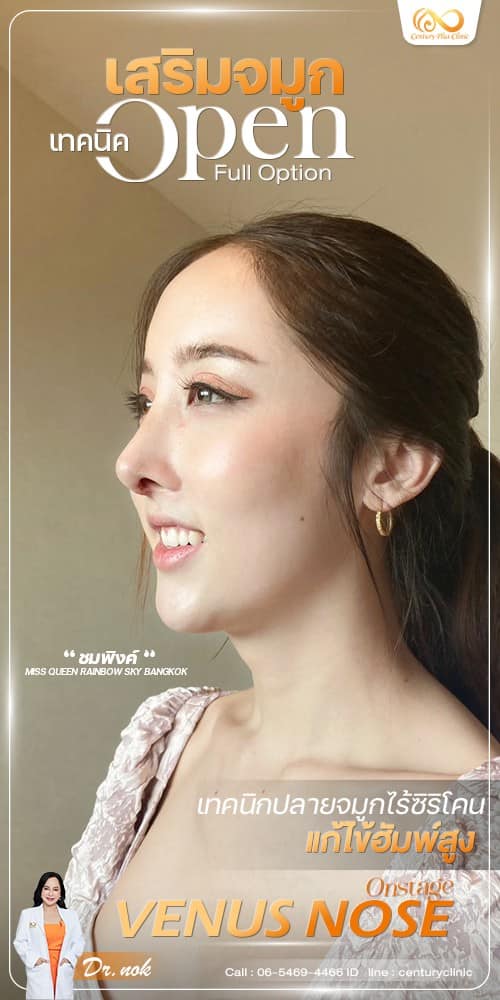 เสริมจมูก #1262